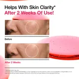 	ANUA Niacinamide 10% TXA 4% Serum - before/after