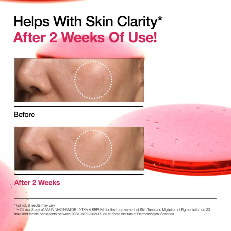 	ANUA Niacinamide 10% TXA 4% Serum - before/after